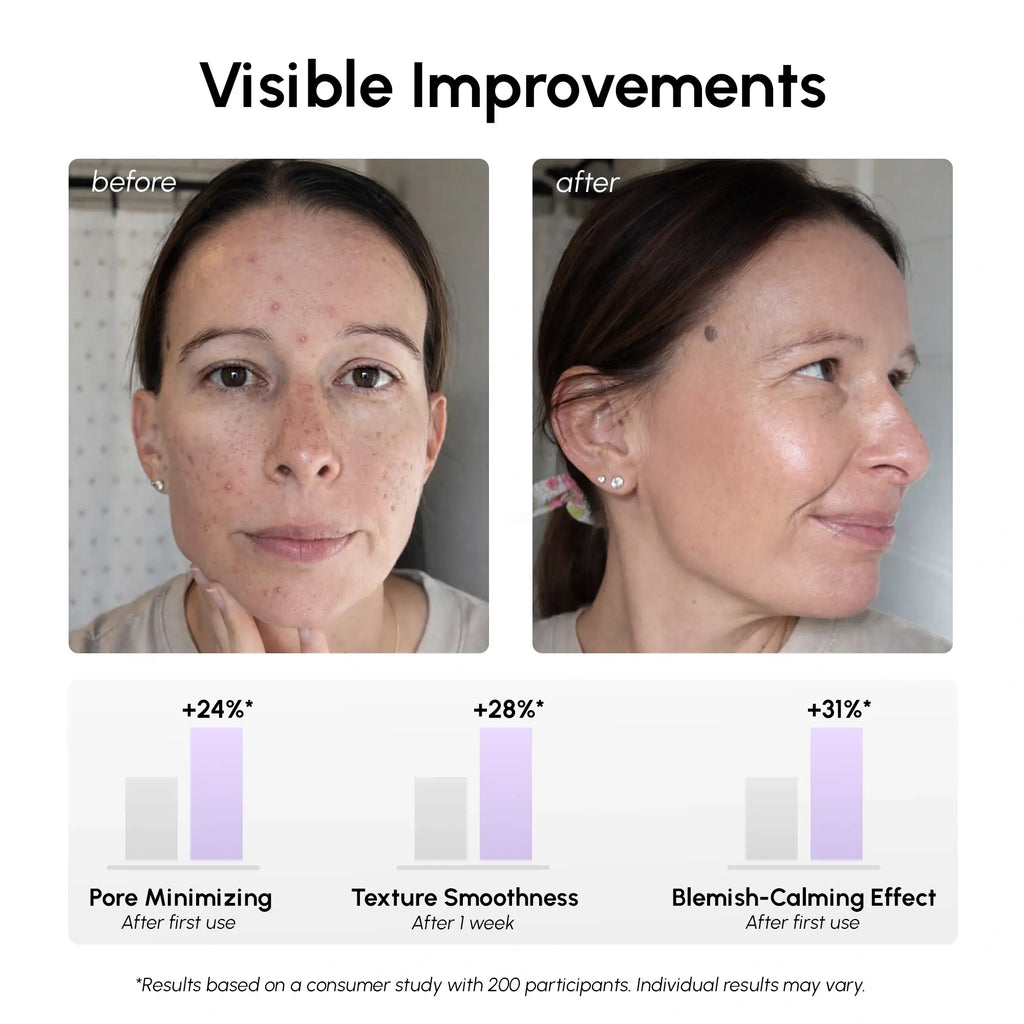 12% Niacinamide Smooth & Glow Pads